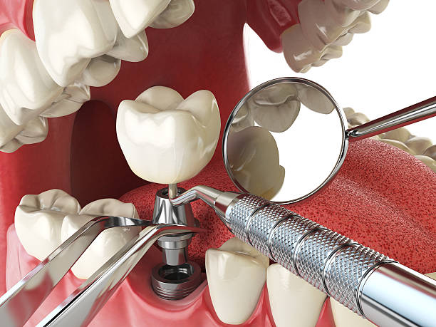 Best Emergency Orthodontic Repairs in South Monrovia Island, CA